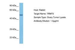 TRMT5 Rabbit anti-Human, Polyclonal, Novus Biologicals 0.1 mL | Buy Online | Novus Biologicals | Fisher Scientific